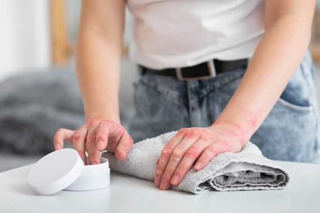 Рекомендации по уходу за кожей после ожогов