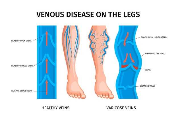 Клинические доказательства: что говорят исследования о заменителях Детралекса