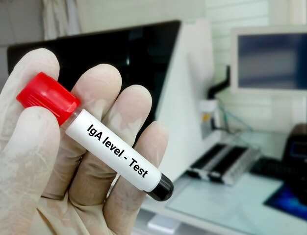 Лучшие практики оптимизации рекламных кампаний через A/B тестирование