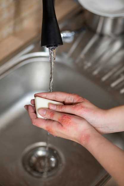 Что делать, если отключили горячую воду