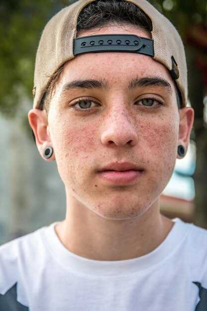 Методы профилактики и советы дерматолога по лечению фотодерматозов