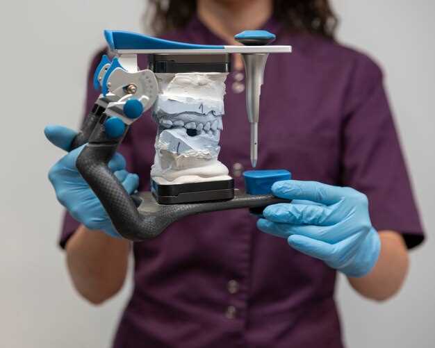 Плюсы и минусы зубных имплантов: что нужно знать перед выбором?