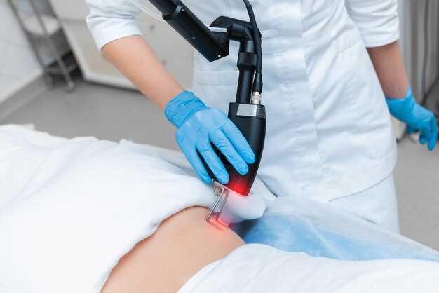 Преимущества и особенности лазерного удаления родинок и других новообразований