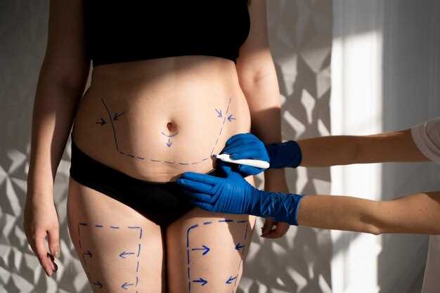 Рекомендации по выбору массажиста для послеоперационного ухода