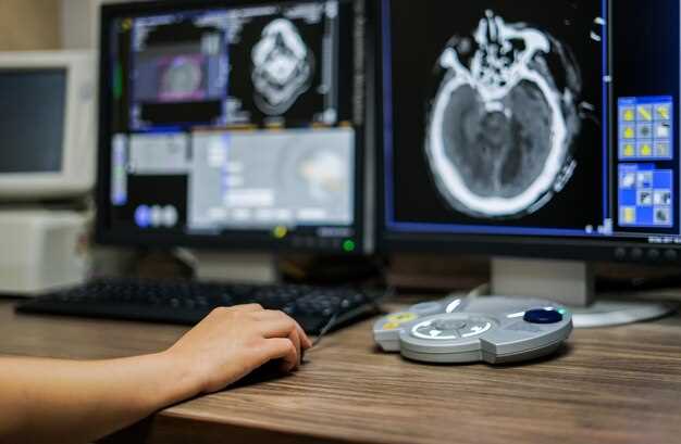 Инновационные технологии AI в лечении эпилепсии