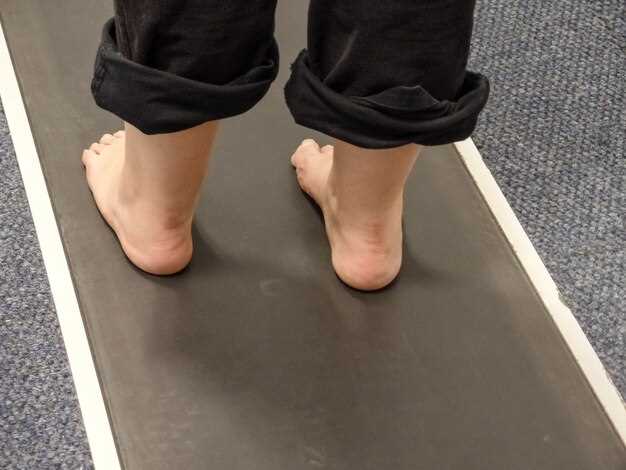 Профилактика плоскостопия у детей: важные аспекты и подходы